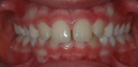pathologie bucco-dentaire